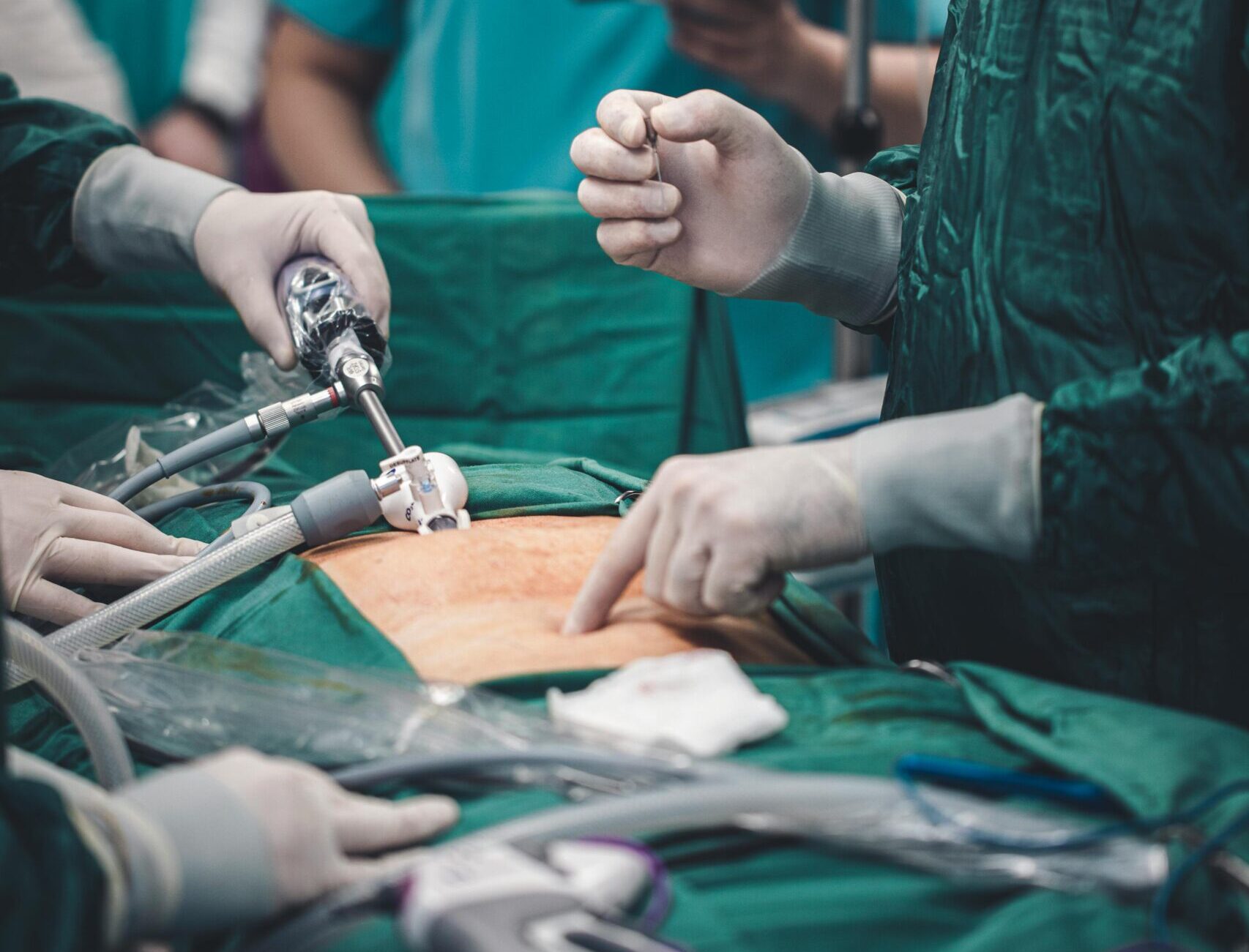 Embalming reference image for dead body transportation services in Delhi NCR by air – required for air cargo compliance